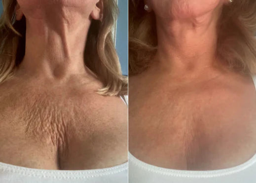 Customer result 1